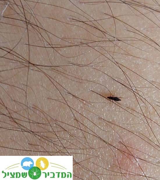 פרעוש עוקץ בן אדם